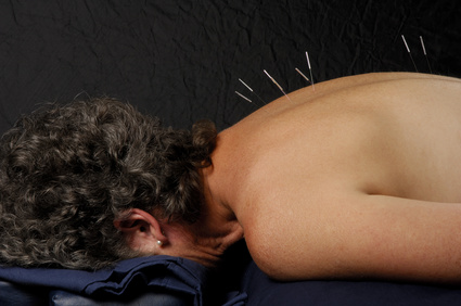Finding Stress Relief Through Acupuncture